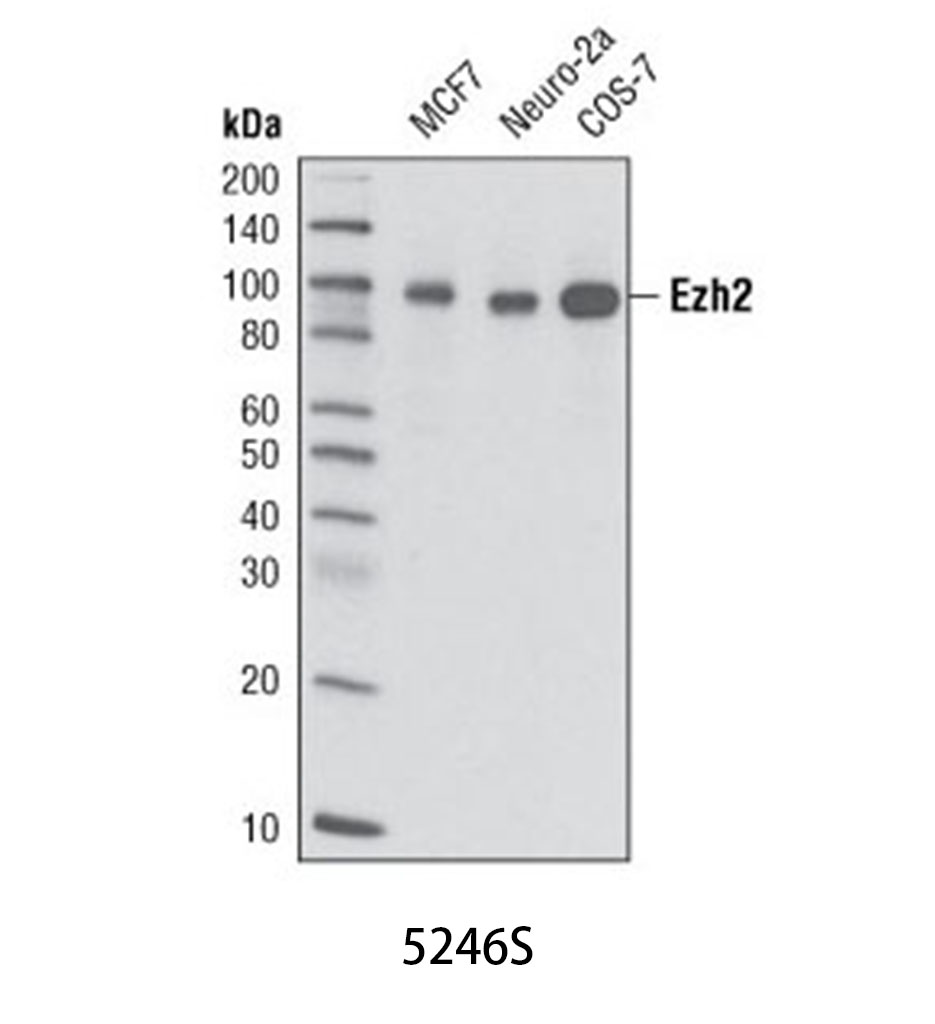 Ezh2 (D2C9) XP Rabbit mAb