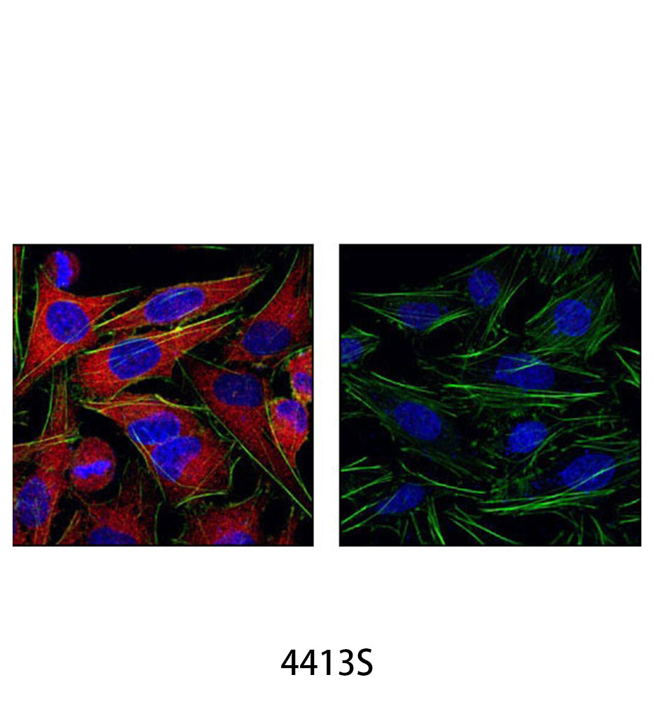 Anti-rabbit IgG (H+L) F(ab')&lt;sub&gt;2&lt;/sub&gt; Fragment (Alexa Fluor 555 Conjugate)