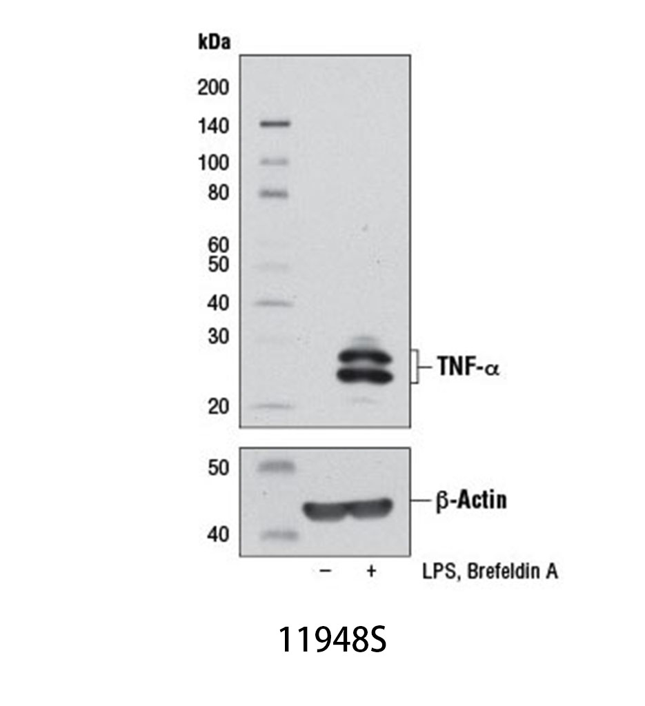 TNF-α (D2D4) XP Rabbit mAb (Mouse Specific)