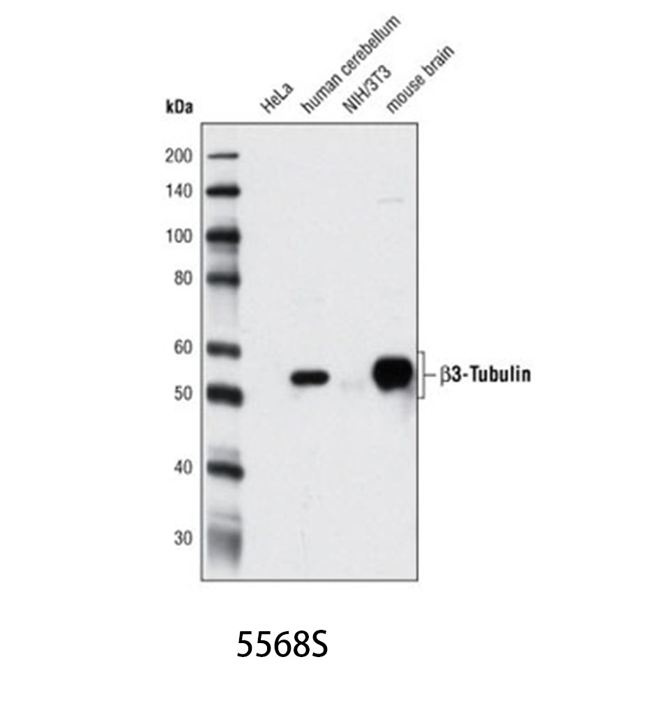 β3-Tubulin (D71G9) XP Rabbit mAb