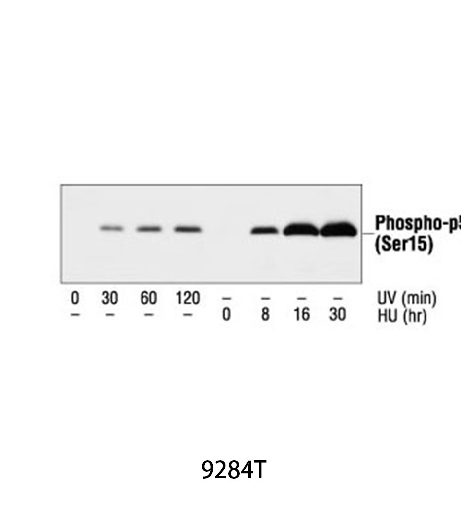 Phospho-p53 (Ser15) Antibody
