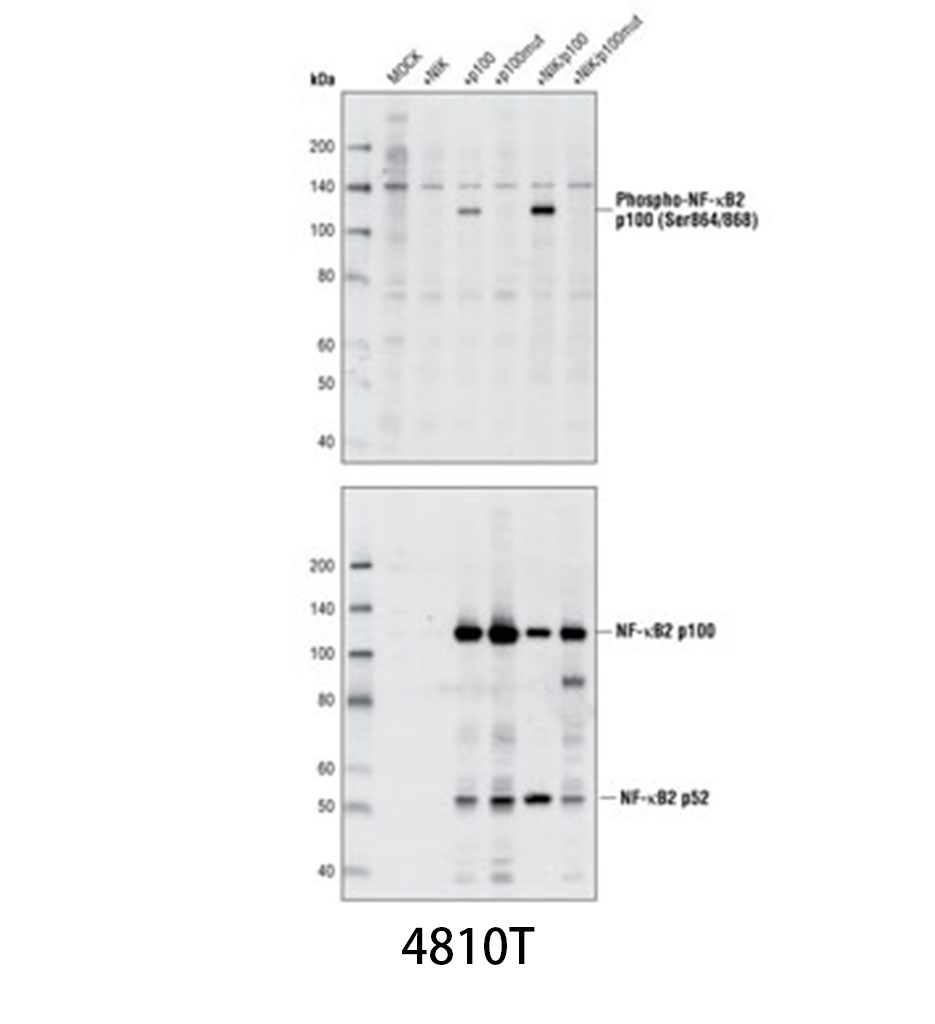 Phospho-NF-κB2 p100 (Ser866/870) Antibody
