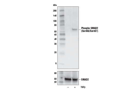 Phospho-SMAD2 (Ser465/Ser467) (E8F3R) Rabbit mAb