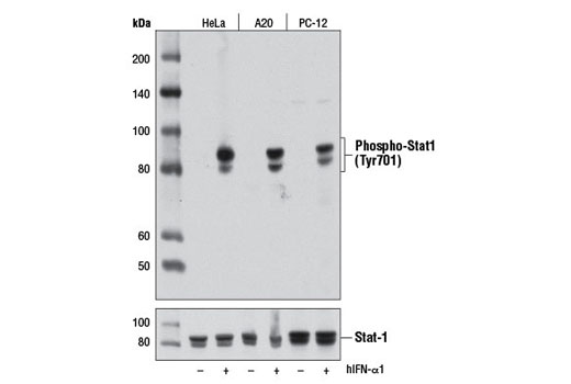 Phospho-Stat1 (Tyr701) (D4A7) Rabbit mAb