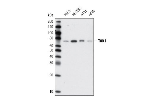 TAK1 (D94D7) Rabbit mAb