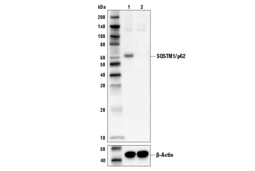 Cleaved Caspase-8 (Asp387) (D5B2) XP Rabbit mAb (Mouse Specific)