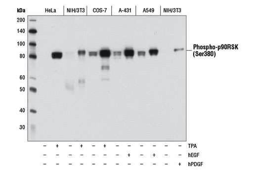 Phospho-Erk1/2 Pathway Sampler Kit