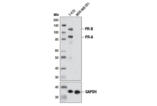 Progesterone Receptor A/B (D8Q2J) XP Rabbit mAb