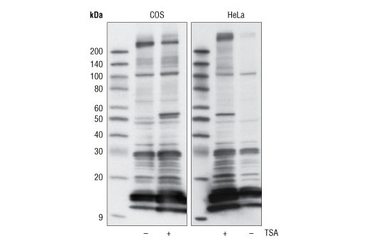 Acetylated-Lysine (Ac-K&lt;sup&gt;2&lt;/sup&gt;-100) MultiMab Rabbit mAb mix