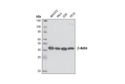 β-Actin (13E5) Rabbit mAb (HRP Conjugate)