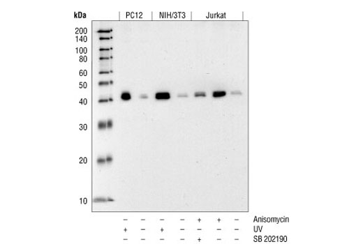 Phospho-p38 MAPK (Thr180/Tyr182) (12F8) Rabbit mAb
