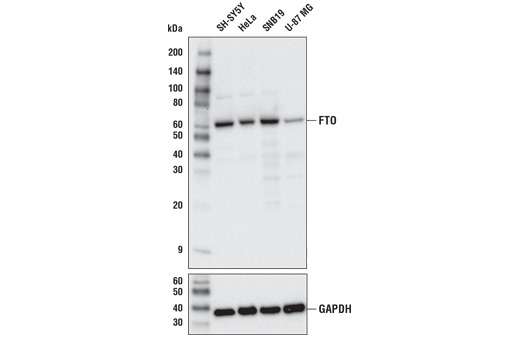 FTO (D6Z8W) Rabbit mAb