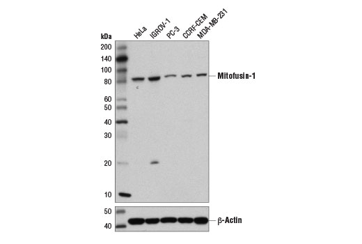Mitofusin-1 (D6E2S) Rabbit mAb