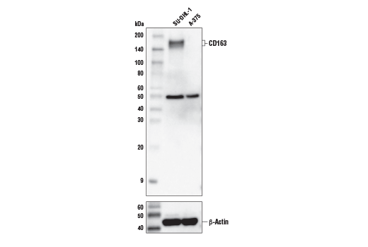 CD163 (D6U1J) Rabbit mAb