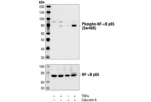 Phospho-NF-κB p65 (Ser468) Antibody