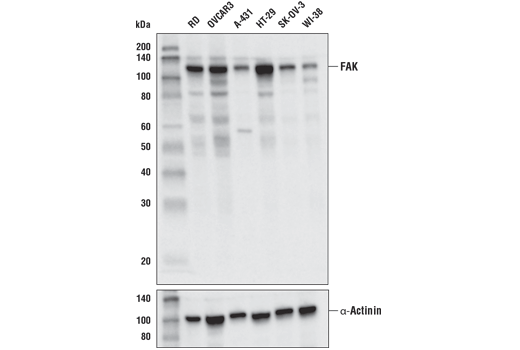 FAK (D5O7U) XP Rabbit mAb