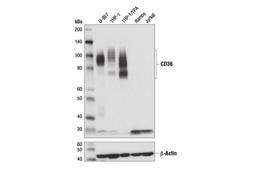 CD36 (D8L9T) Rabbit mAb