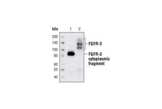 FGF Receptor 3 (C51F2) Rabbit mAb