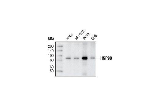 HSP90 (C45G5) Rabbit mAb