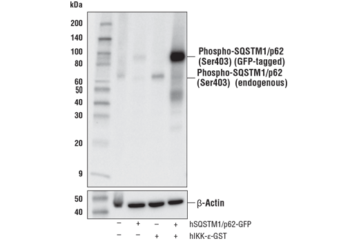 Phospho-SQSTM1/p62 (Ser403) (D8D6T) Rabbit mAb