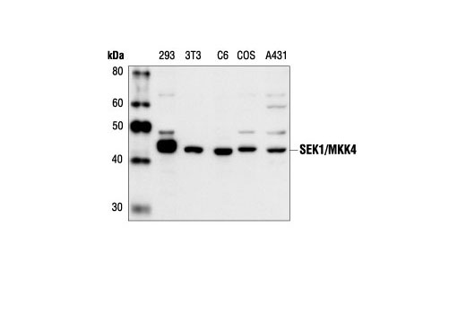 SEK1/MKK4 Antibody