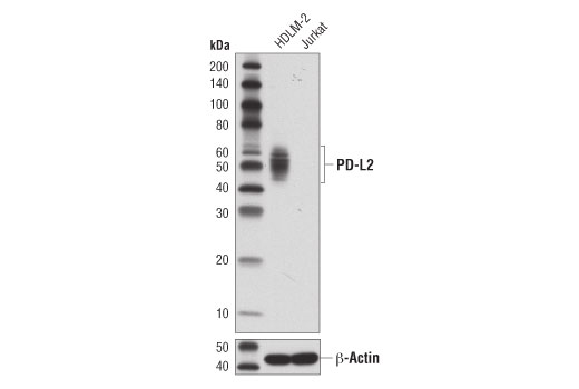 PD-L2 (D7U8C) XP Rabbit mAb