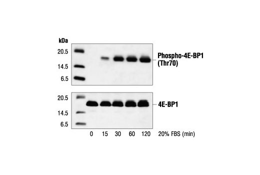 Phospho-4E-BP1 (Thr70) Antibody