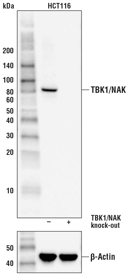 TBK1/NAK (D1B4) Rabbit mAb
