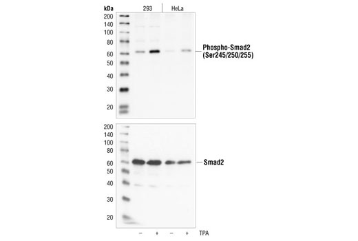 Phospho-Smad2 (Ser245/250/255) Antibody