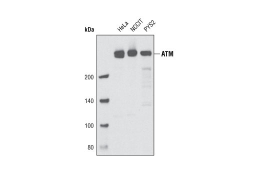 ATM (D2E2) Rabbit mAb