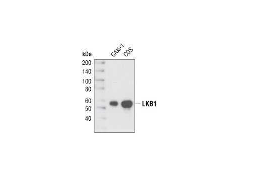 LKB1 (27D10) Rabbit mAb