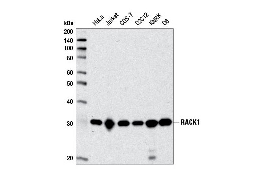 RACK1 (D59D5) Rabbit mAb