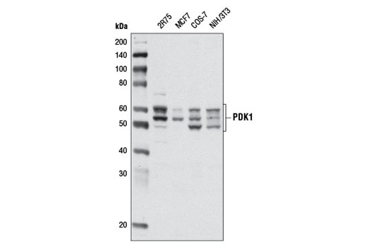 PDK1 (D37A7) Rabbit mAb