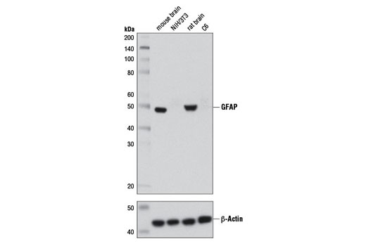 GFAP (D1F4Q) XP Rabbit mAb