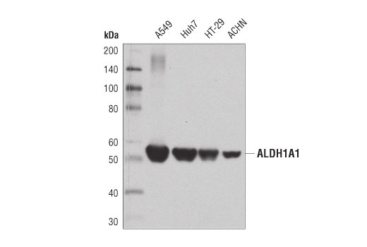 ALDH1A1 (D9Q8E) XPRabbit mAb