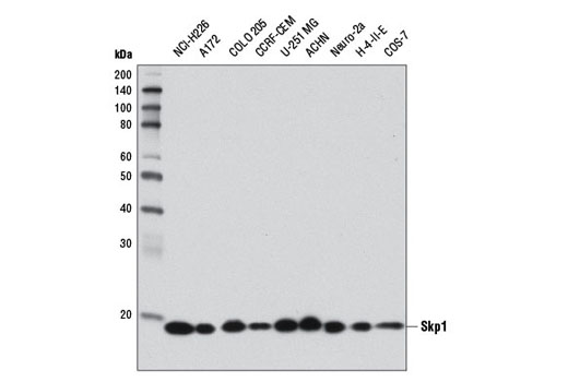 Skp1 (D3J4N) Rabbit mAb