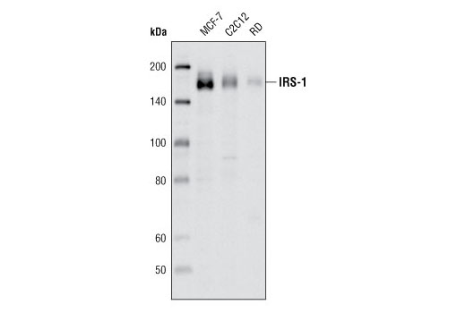 IRS-1 (D23G12) Rabbit mAb
