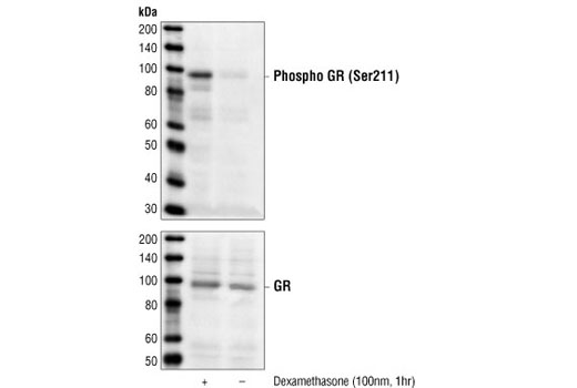 Phospho-Glucocorticoid Receptor (Ser211) Antibody