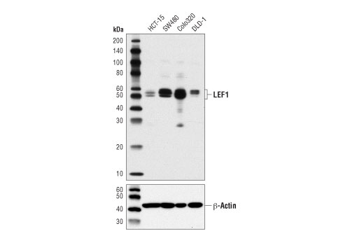 LEF1 (D6J2W) Rabbit mAb