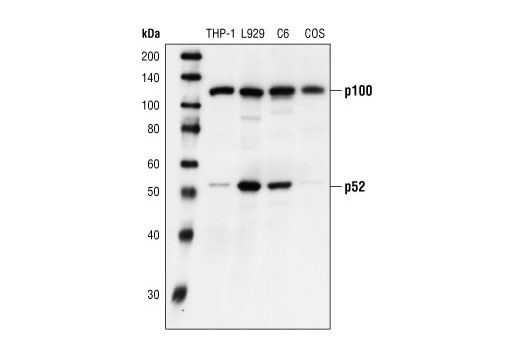 NF-κB2 p100/p52 Antibody