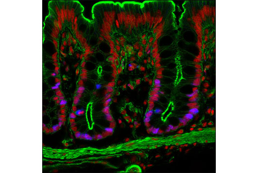 Ki-67 (D3B5) Rabbit mAb (Alexa Fluor 647 Conjugate)