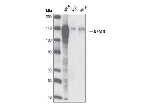 NFAT3 (23E6) Rabbit mAb
