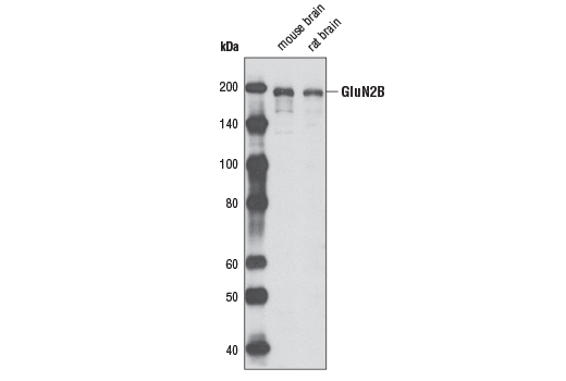 NMDA Receptor 2B (GluN2B) Antibody