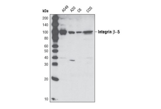 Integrin β5 (D24A5) Rabbit mAb