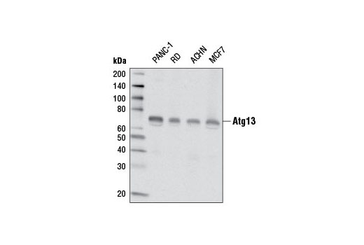 Atg13 (E1Y9V) Rabbit mAb