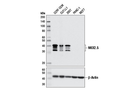 NKX2.5 (E1Y8H) Rabbit mAb