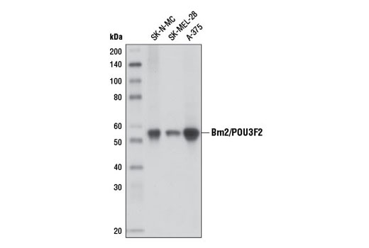 Brn2/POU3F2 (D2C1L) Rabbit mAb
