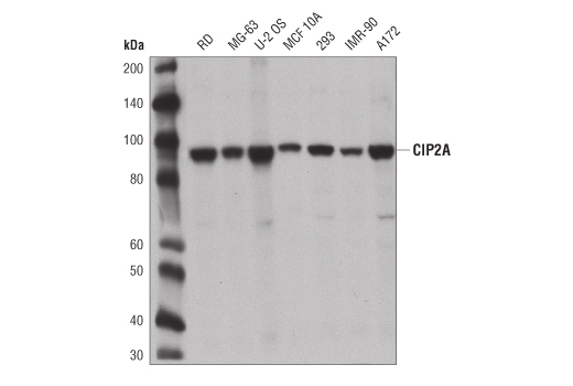CIP2A (D1M3H) Rabbit mAb