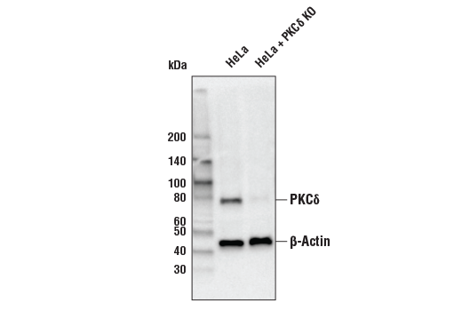 PKCδ (D10E2) Rabbit mAb