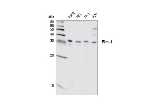Pim-1 (C93F2) Rabbit mAb